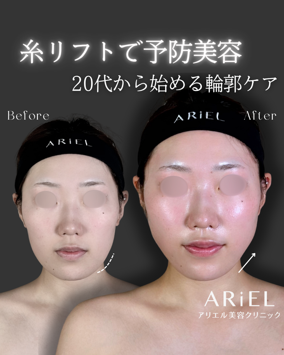 No.9195の症例写真